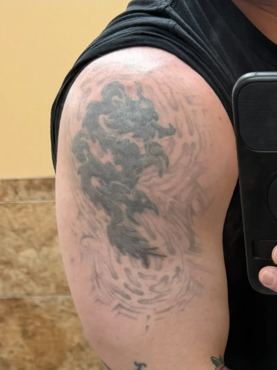 Upper arm before a cover-up, showing a faded dark tattoo that had already been laser lightened, at True North Tattoo in Lancaster, PA